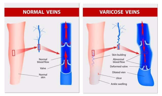 Hobbies | Personal Achievements | Athens Vascular and Vein